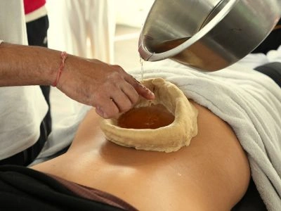 An authentic Kati Vasti oil treatment for back pain relief during professional Ayurveda retreats in Rishikesh.